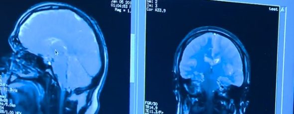 A scan of a human brain is seen in this undated file photo | James Alexander Michie